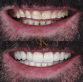 caso 1 - Doctor Eduardo Crooke