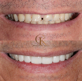 caso 2 - Doctor Eduardo Crooke