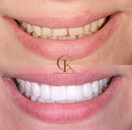 caso 4 - Doctor Eduardo Crooke